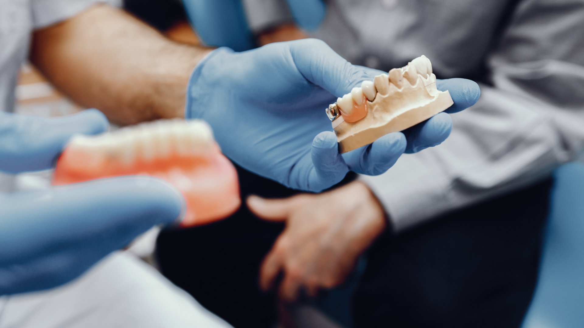 Mi alapján válasszak implantológust Budapesten? | RózsaDomb DentCare