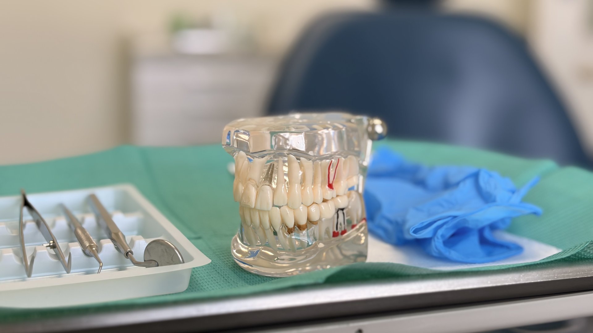 All-on-4 műtét napja és az első hét | RózsaDomb DentCare