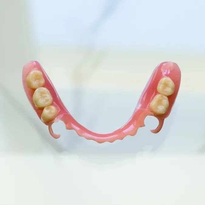 Valplast műfogsor Budapest – rugalmas, fémmentes fogpótlás