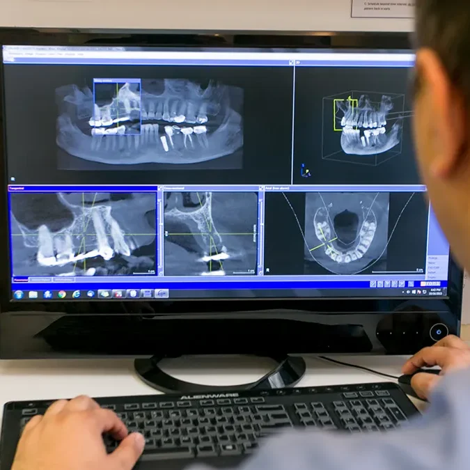 rozsadomb-dentcare-CBCT-kep-2